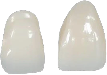 Two zirconia anterior crowns